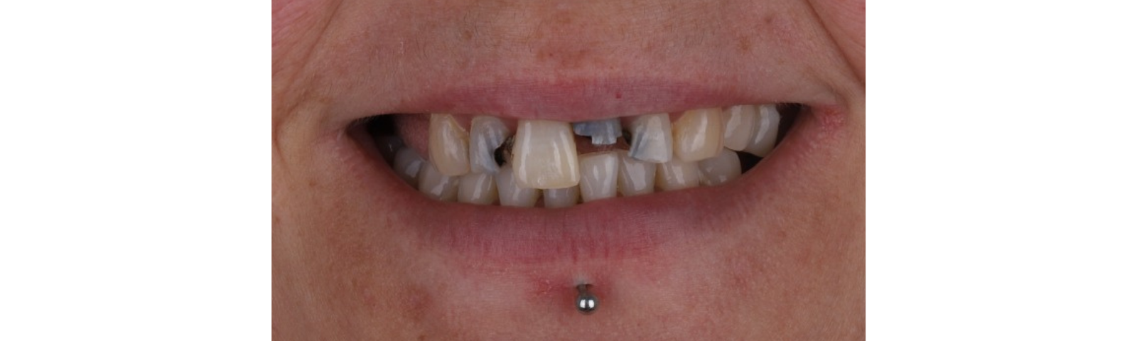 Before