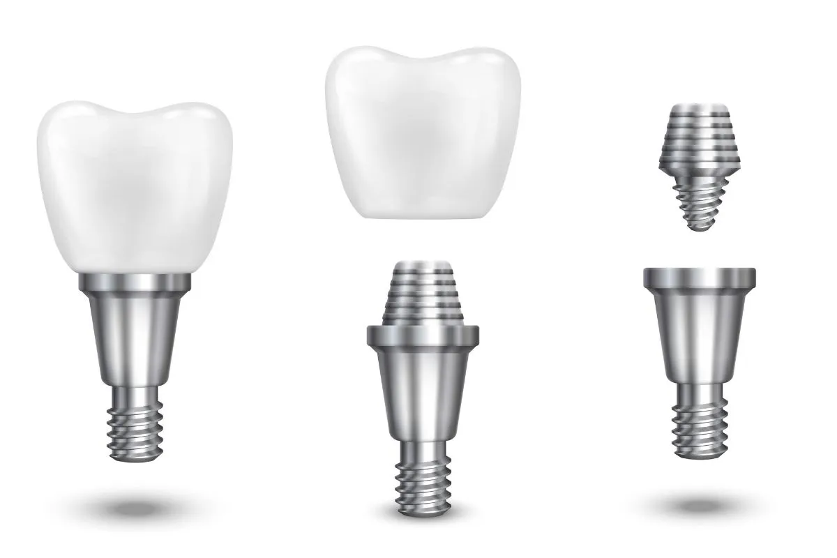 Dental Implants