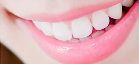 Just finished your teeth whitening?