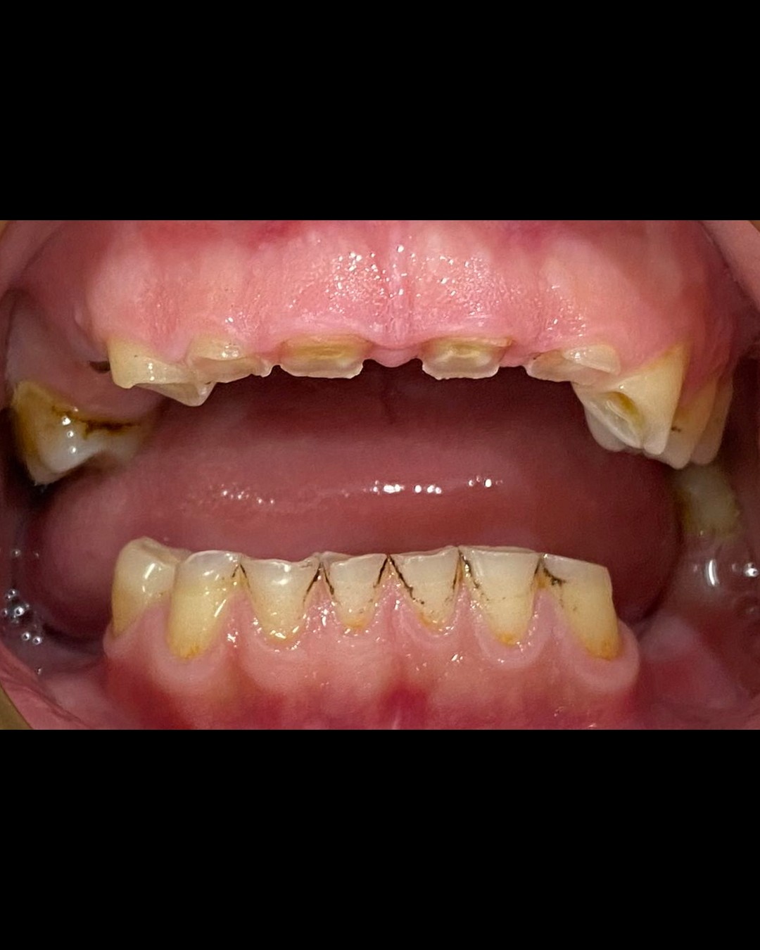 SnapInsta.to_666194838_122163163358856406_6983163720392035438_n