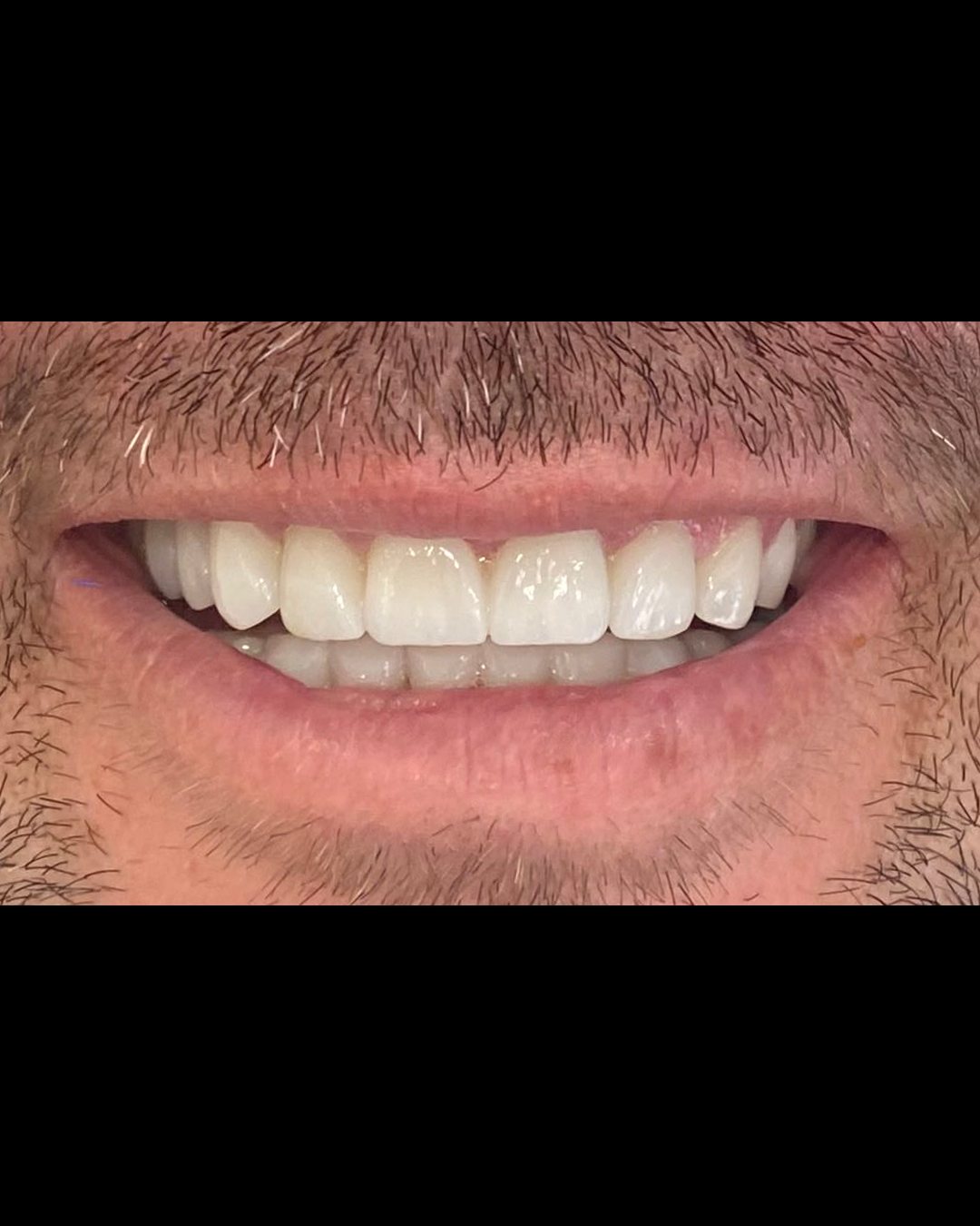 snapsave-app_3870058294237179216