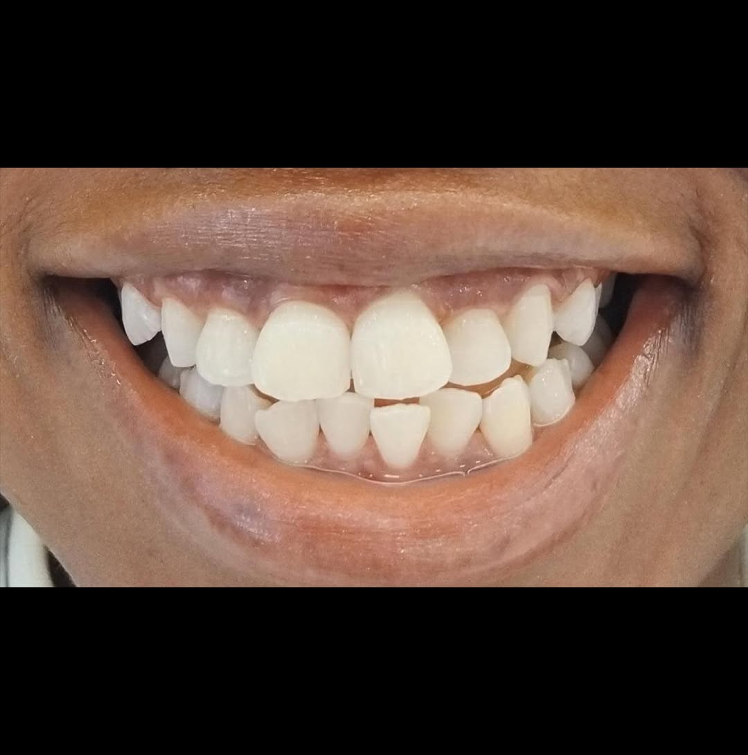 snapsave-app_3872105695483941075 (1)